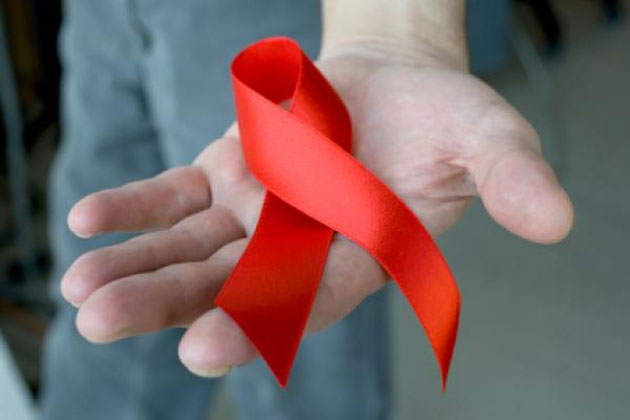 34488-aids